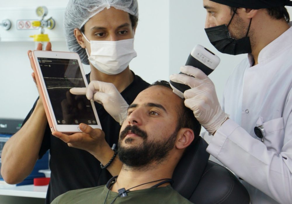 exploring-hair-transplant-technologies